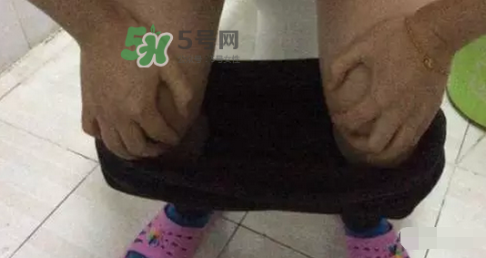 孕期可以蹲著上廁所嗎？孕期上廁所會壓到寶寶嗎？