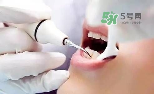 孕婦能矯正牙齒嗎？懷孕期間可以矯正牙齒嗎？