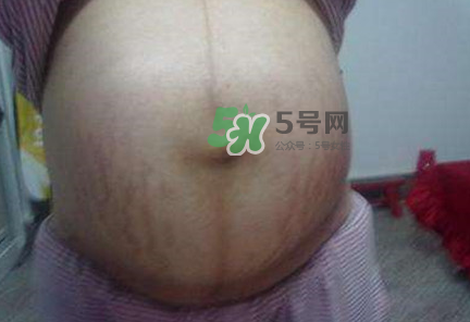 懷女孩肚子上會長毛嗎？懷女孩肚子特征圖片