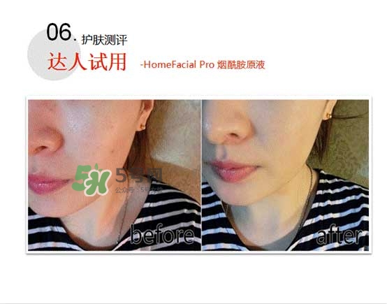homefacialpro煙酰胺原液怎么樣？hfp煙酰胺原液好用嗎