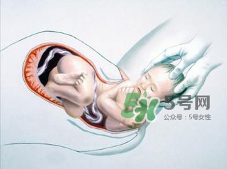 順產(chǎn)和剖腹產(chǎn)哪個(gè)好？順產(chǎn)和剖腹產(chǎn)哪個(gè)痛？
