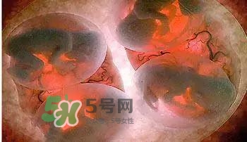 多胞胎順產(chǎn)怎么生？多胞胎剖腹產(chǎn)和單胎剖腹產(chǎn)的區(qū)別