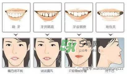 乳牙齲齒要不要補？乳牙齲齒怎么辦？
