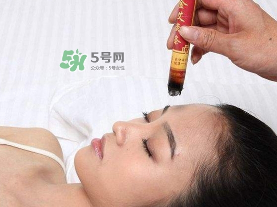 艾灸會(huì)不會(huì)過敏？艾灸過敏怎么辦