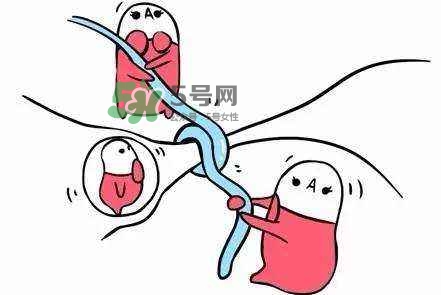 結(jié)扎好還是上環(huán)好？結(jié)扎上環(huán)哪個(gè)危害?。?></p><p style=