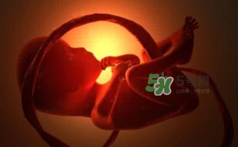 寶寶臍帶繞頸只能剖腹產嗎？胎兒臍帶繞頸孕婦有什么感覺