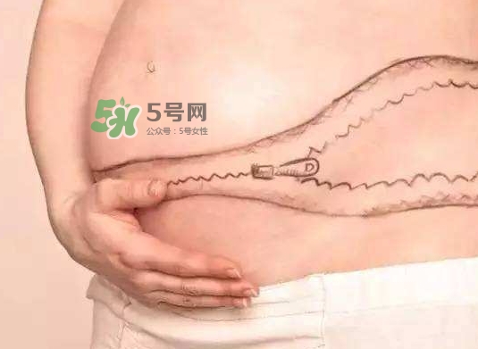 剖腹產(chǎn)疤痕怎么去除？剖腹產(chǎn)疤痕能去掉嗎？