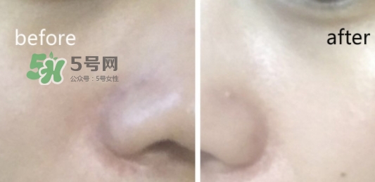 hr綠寶瓶新肌水怎么用？赫蓮娜綠寶瓶新肌水使用方法