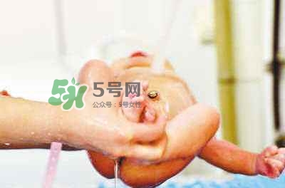 羊水栓塞是醫(yī)療事故嗎？羊水栓塞多發(fā)生于順產(chǎn)還是剖腹產(chǎn)？