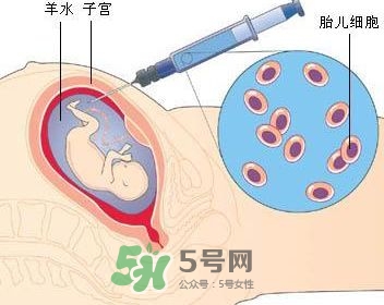 羊水栓塞是怎么回事？羊水栓塞怎么預防？
