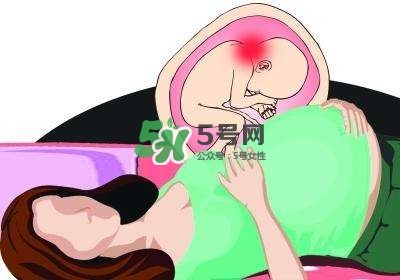 孕婦左側(cè)臥睡不著怎么辦？孕期左側(cè)睡不舒服怎么辦？