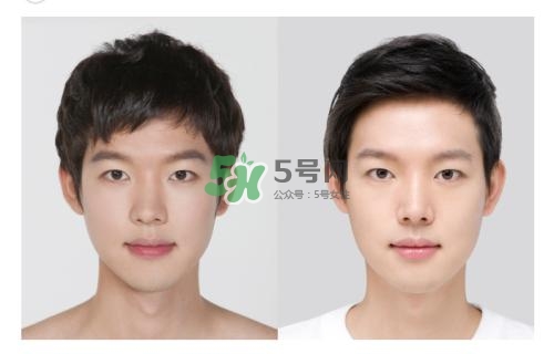 美白針有副作用嗎？美白針有什么副作用？