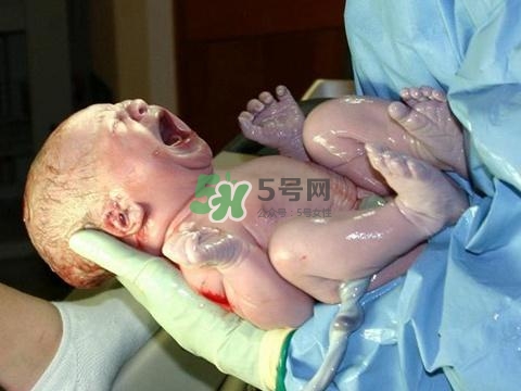 順產(chǎn)有多疼？順產(chǎn)的疼痛可以忍受嗎？