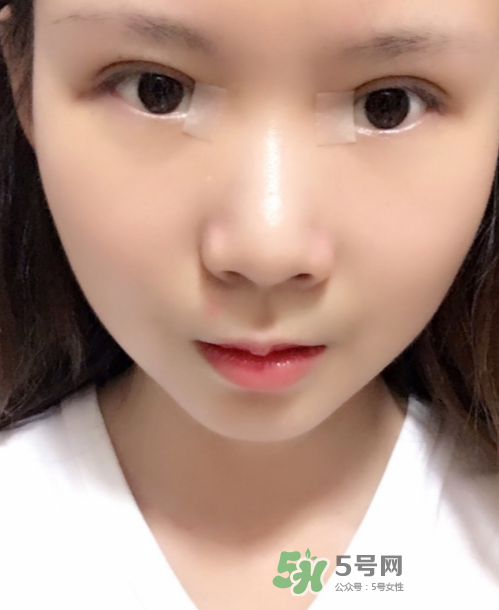 美皮護去疤效果怎么樣？美皮護有用嗎？