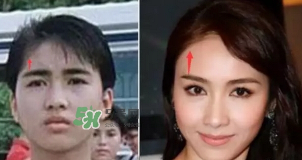 發(fā)際線低怎么調(diào)整？標(biāo)準(zhǔn)的發(fā)際線圖片