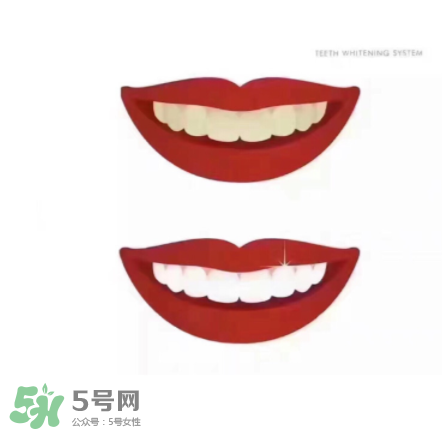 美牙儀能帶上飛機(jī)嗎？美牙儀可以過安檢嗎？