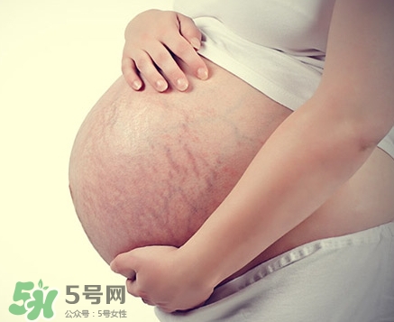 孕婦胸部長妊娠紋嗎？胸部長妊娠紋了怎么辦？