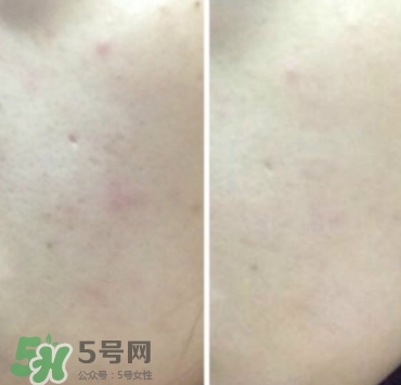美康粉黛氣墊bb怎么樣？美康粉黛氣墊bb毀容