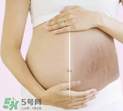 長妊娠紋的前兆 長妊娠紋很癢怎么辦？