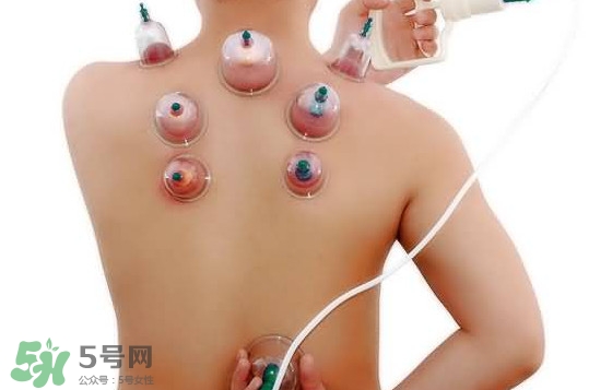 火罐和真空罐哪個(gè)好？真空罐和火罐效果一樣好嗎