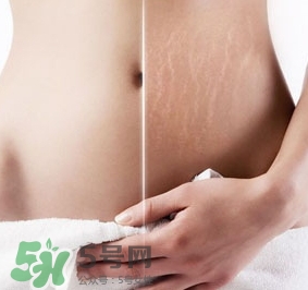 妊娠紋什么時候變白？妊娠紋產(chǎn)品什么時候用？