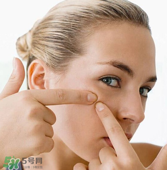 長痘長閉口怎么辦？長痘長閉口是什么原因？