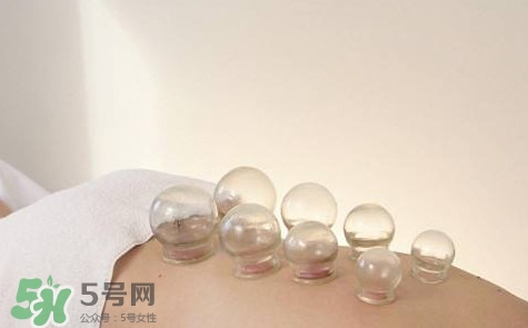 真空拔罐有用嗎？真空拔罐多長時(shí)間合適