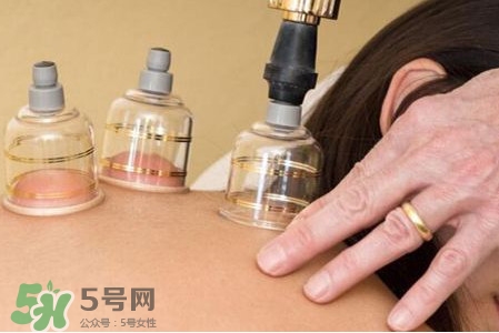 真空拔罐有用嗎？真空拔罐多長時(shí)間合適