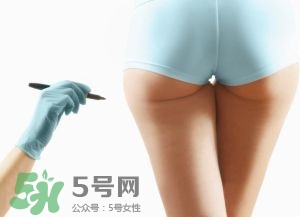 吸脂減肥副作用有哪些？吸脂減肥可靠嗎？