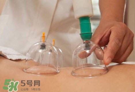 真空拔罐有用嗎？真空拔罐多長時(shí)間合適
