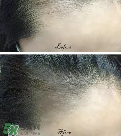 發(fā)際線粉要卸妝嗎_怎么卸？