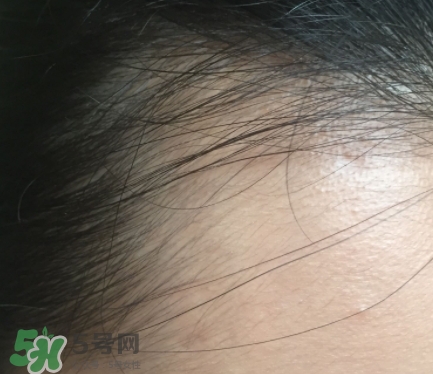 發(fā)際線粉要卸妝嗎_怎么卸？