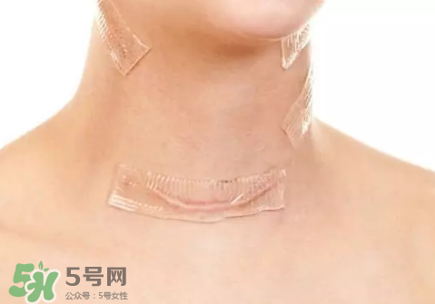 硅膠疤痕貼有用嗎？硅膠疤痕貼效果怎么樣？