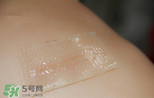 仙卡疤痕貼有用嗎？仙卡疤痕貼效果怎么樣？