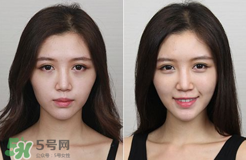 蘋果肌怎么化？蘋果肌究竟哪里好？