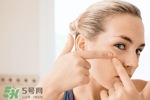 暗瘡可以擠壓嗎？油性和骯臟肌膚會容易有暗瘡嗎？