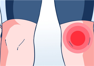 風(fēng)濕可以泡腳嗎？風(fēng)濕可以泡溫泉嗎？