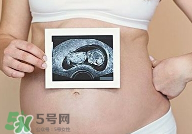雙子宮可以上環(huán)嗎？雙子宮上環(huán)要注意哪些？