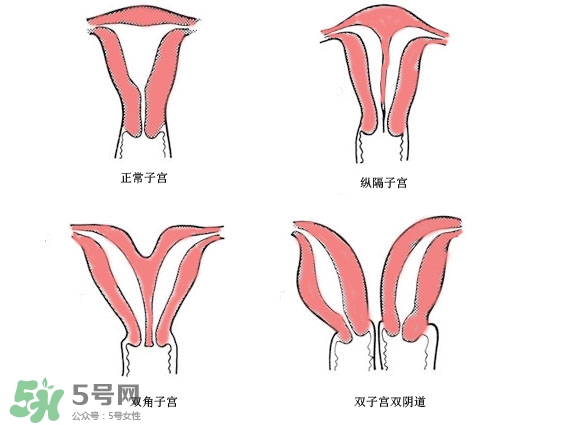 雙子宮是什么意思？雙子宮可以順產(chǎn)嗎？