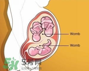 雙子宮是什么意思？雙子宮可以順產(chǎn)嗎？