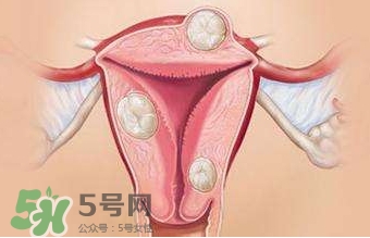 雙子宮可以上環(huán)嗎？雙子宮上環(huán)要注意哪些？