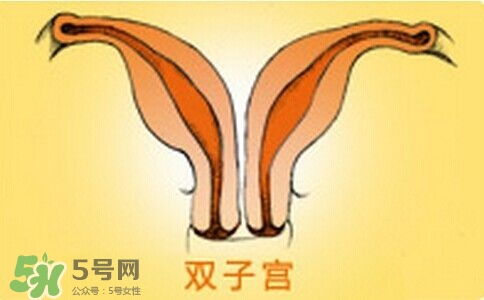 雙子宮是什么意思？雙子宮可以順產(chǎn)嗎？
