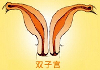 雙子宮是什么意思？雙子宮可以順產(chǎn)嗎？