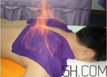 火療真的能治病嗎？火龍液的功效與作用