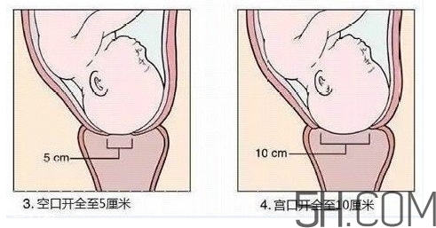 內(nèi)檢是什么感覺？內(nèi)檢有男醫(yī)生嗎？