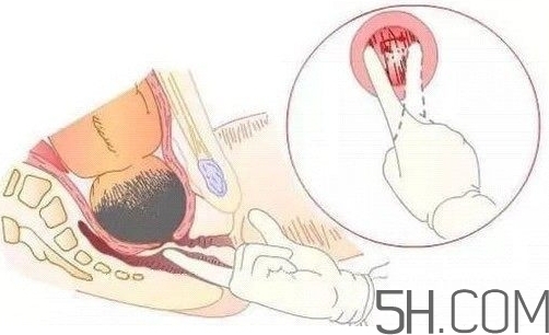 內(nèi)檢是什么感覺？內(nèi)檢有男醫(yī)生嗎？