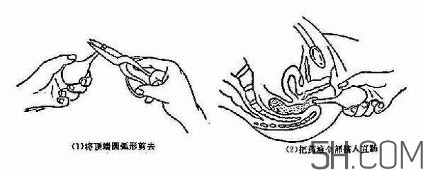 開塞露怎么用？開塞露用后多久會排便？