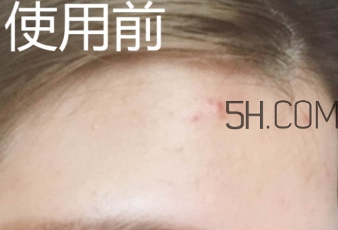 essence雙色遮瑕膏怎么用？essence雙色遮瑕膏使用心得