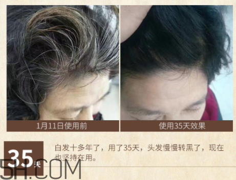 詩碧曼美發(fā)精華液價(jià)格 詩碧曼美發(fā)精華液評(píng)測(cè)