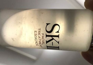 sk2神仙水有絮狀沉淀物正常嗎_是不是假貨